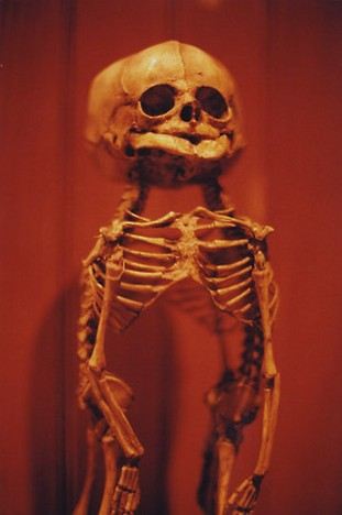 毛骨悚然!收藏畸形人遗体的最恐怖尸体博物馆