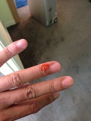 何炅谢娜变疯狂吸血鬼粉丝李维嘉惨被马咬破手2