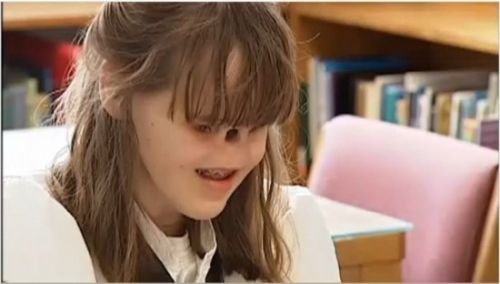 女孩患天生缺鼻子少眼揭全球罕见怪病图3