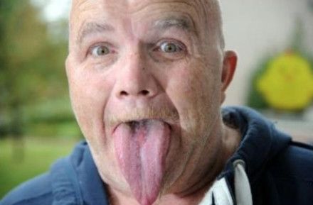 英国男子舌头超过10公分 科学家难解原因(图)