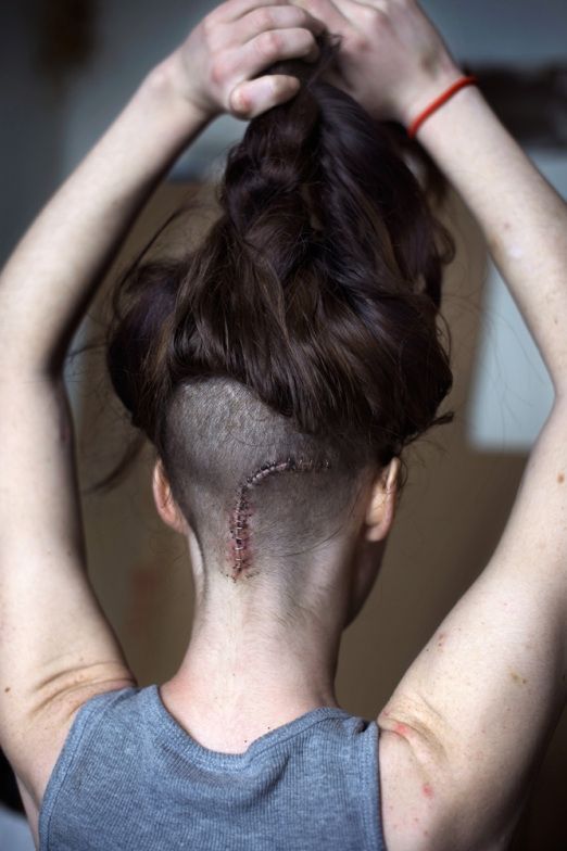 纪实摄影:吸毒女孩的破茧之路【17】