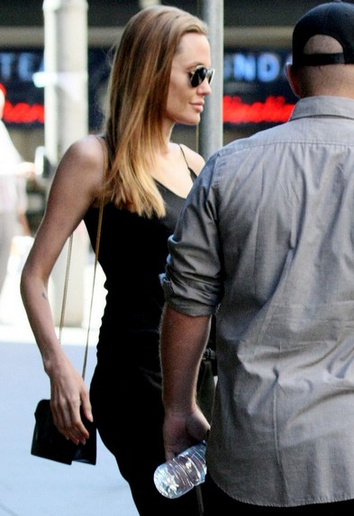 曝朱莉双乳重建手术出现并发症常感到疼痛5