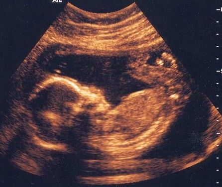 鲜为人知的十大怀孕现象 男婴在子宫里勃起【2】