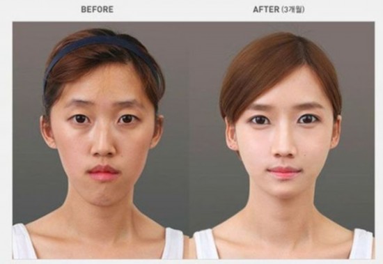 图揭日韩女生整容实录 日本女生整成"瓷娃娃" (组图)【17】