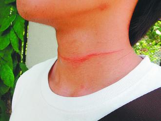 风筝断线变隐形杀手 男子骑车被线勒住险被割颈