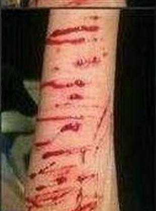 变形计李耐阅完整版资料 男友和整容前后对比照曝光【2】