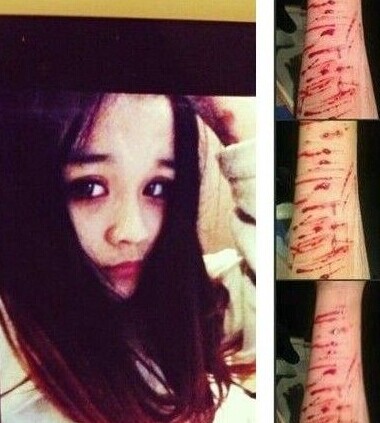 《变形记》李耐阅王骁接吻照片疯传 微博晒自残照令人咋舌【4】