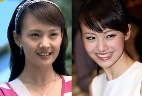 郑爽整容前后对比
