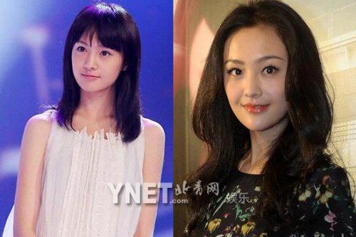 郑爽整容后张翰惊呆 郑爽张翰分手内幕揭秘李菲儿被指当小三是真的吗?