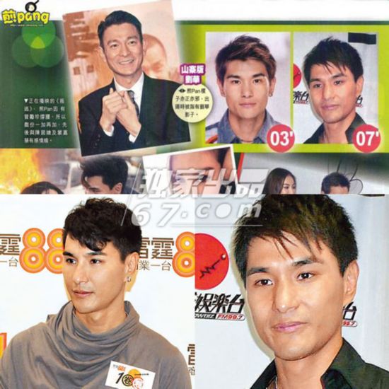 陈展鹏疑整容解释为脸部水肿