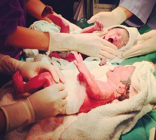 范玮琪产双胞胎 人工受孕对宝宝好吗