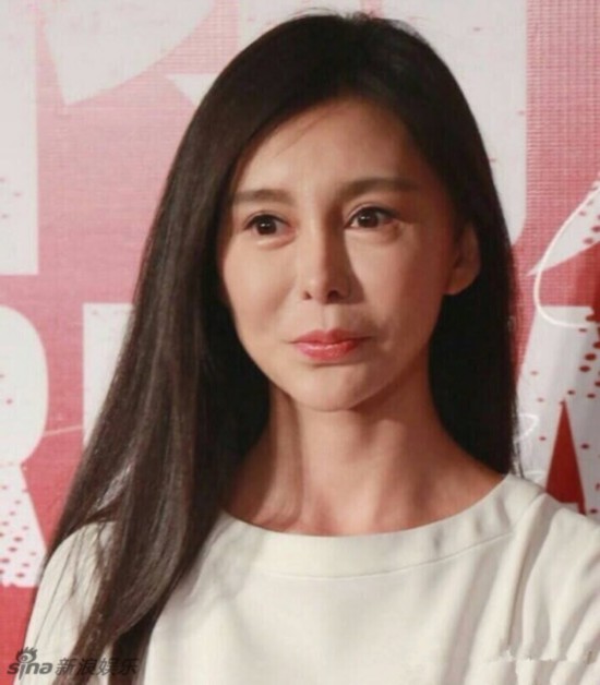 巩新亮被疑整容失败 面部僵硬吓呆网友(图)