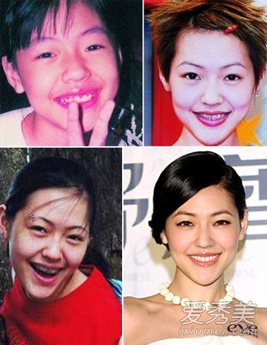 相爱穿梭千年郑爽美丽但颜僵 到底女星整容后遗症容谁更惨?