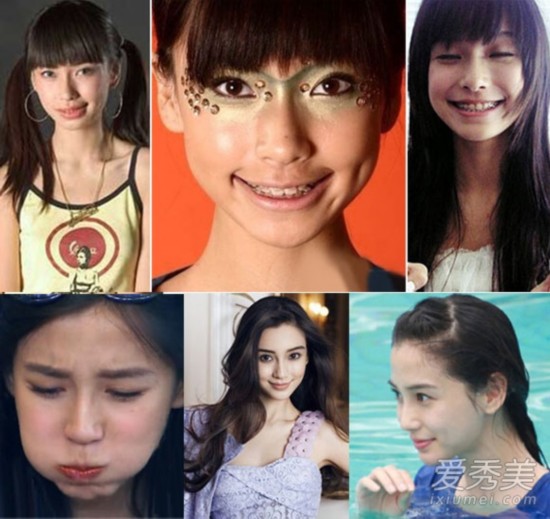 唐嫣孙俪张靓颖范冰冰angelababy杨幂 明星整容前丑到掉渣