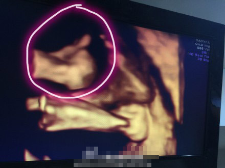怀孕6个月清晰b超图图片