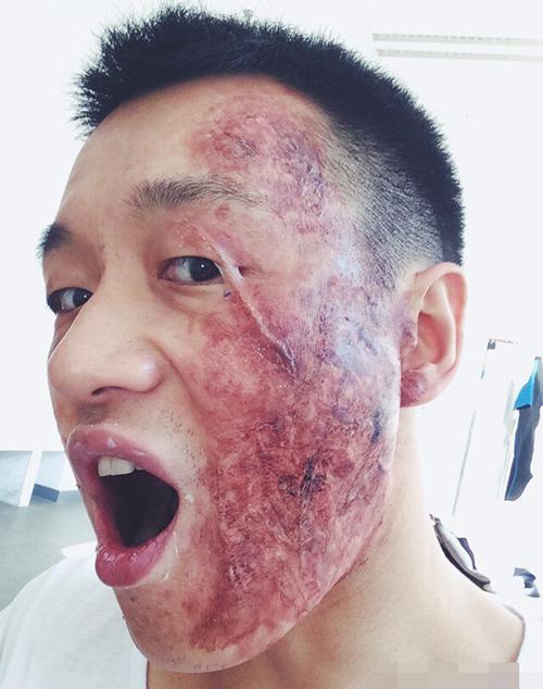 黑龙江频道 娱乐时尚     早期,佟大为在微博晒出脸部被化得满是伤疤