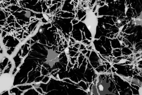 神秘萎缩脑细胞或同阿尔茨海默氏症相关