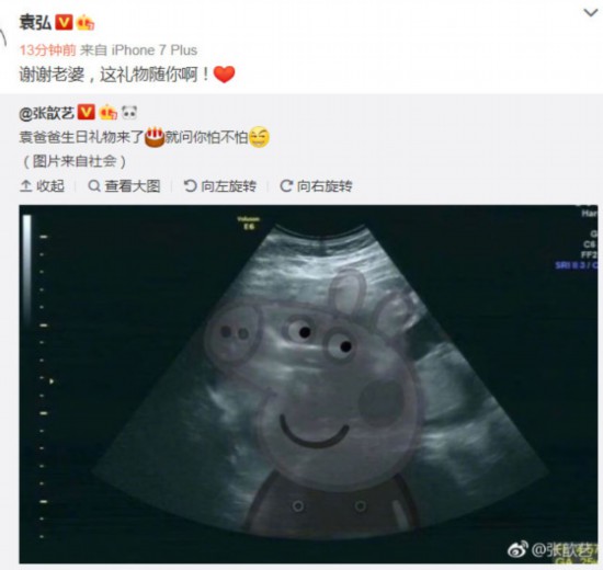 八月喜事张歆艺晒b超照宣布怀孕袁弘回复随你两人超美婚纱照回顾