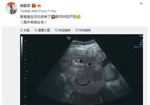 张歆艺晒b超照宣布怀孕为袁弘庆生网友:果然嫁对人