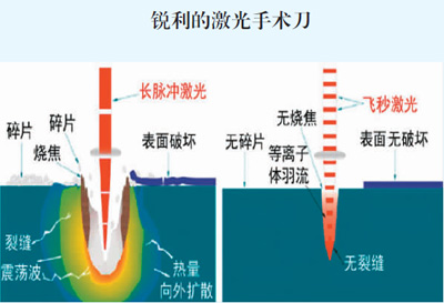 镊子,手术刀激光做