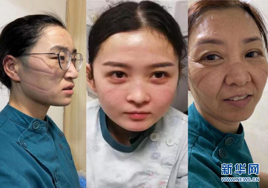 多地一线抗疫医务人员工作影像实录6